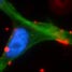 Docetaxel hits its target