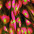 Bone marrow cells