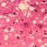 BSE - cytoarchitectural histopathologic changes in the brain. CDC/DR. Al Jenny