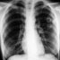 lungs