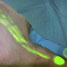 Pig's hind leg with lymph flow highlighted after injection and imaging with near-infrared contrast agents