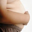 Obesity in children is an increasing problem