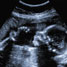 Are developing brains at risk?