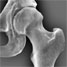 Hip joint