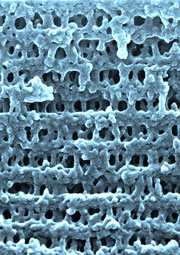 Osmotic shock
