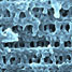 Osmotic shock