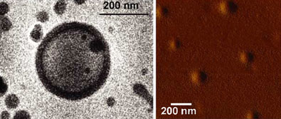 Polymer vesicles