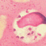 Leishmania donovani