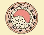 Regulator rebuffs Marck's cholesterol drug