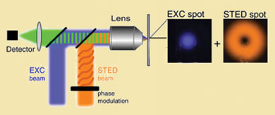 The million dollar microscope 