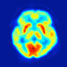 Radiolabel imaging