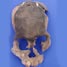 Adult trophy head
