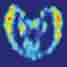 Positron emission tomography
