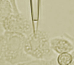 Attosyringe in action