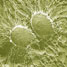 Staphylococcus aureus (MRSA)