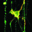 A neuron grown in a microfluidic device