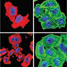 Immunofluorescence microscopy shows effects of magnetic field hyperthermia on tubulin and actin