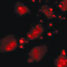 Escherichia coli treated with a hydrogelator precursor stained by Congo red dye