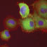 Cells stuck to a polyurethane surface treated with zirconium tetra(tert-butoxide) and a cell-adhesive peptide