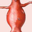 Aorta with aneurysm