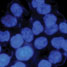 Cancer cells