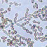 Micrograph of cladosporium fungus