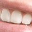 white teeth