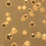 Bacteria