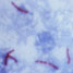 Mycobacterium tuberculosis bacteria