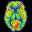 PET scan of brain