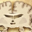 Cartoon brain