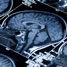 Magnetic resonance image of a brain