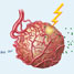 A tumour subjected to radiation therapy, immunotherapy, and antiangiogenesis