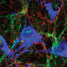 Fluroscence image of tissue growth