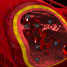 Blood vessel