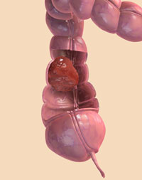 Colon