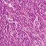 tumour cells