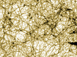 Amyloid fibrils