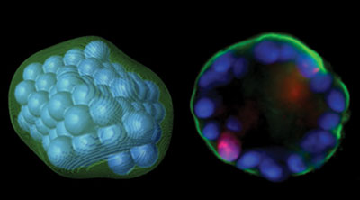 Identify+breast+structures