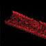 Channelling deeper to target breast cancer