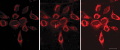 Stained HeLa cells