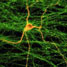 Neuronal pathway