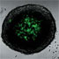 Hypoxic part of tumour