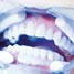 teeth