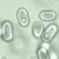 Cyanothece 51142 cyanobacteria