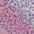 cancer cells