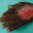 Antibacterial clays kill with iron