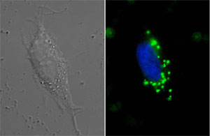 Internalization of green fluorescent diamonds by a cancer cell