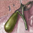 Gall bladder