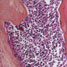 bone marrow